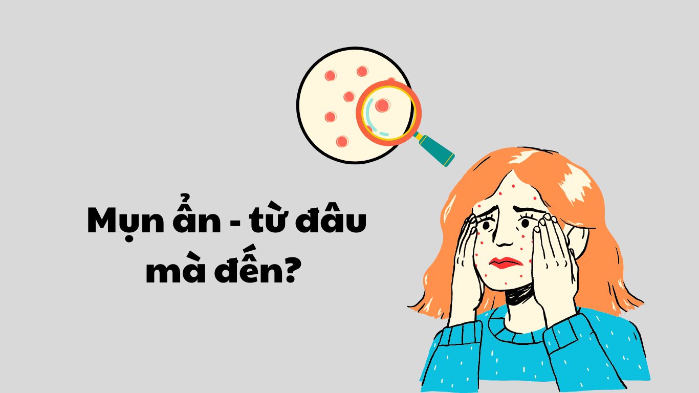 mụn ẩn từ đâu đến